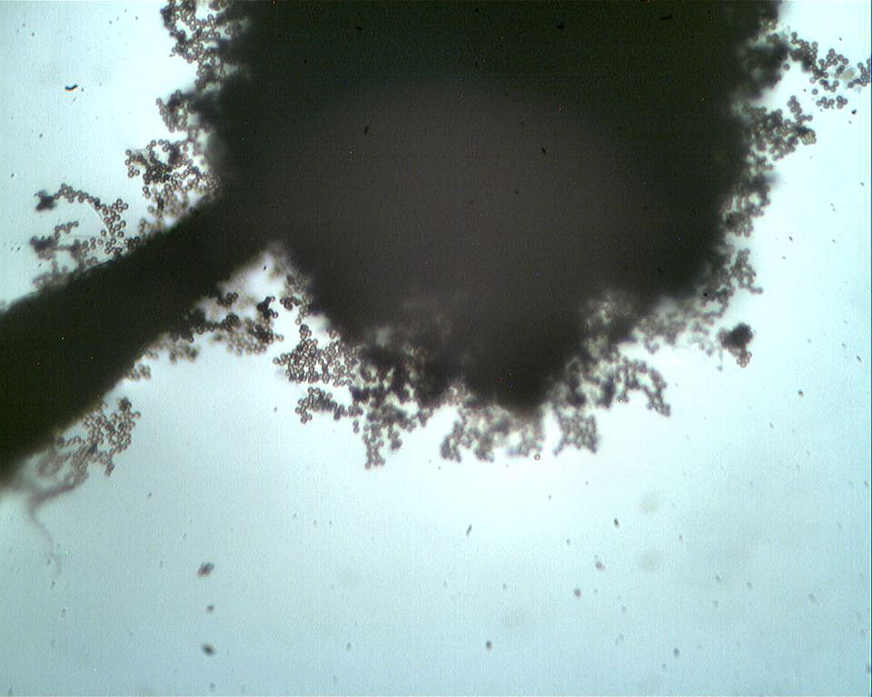 Corticiacea ospitale